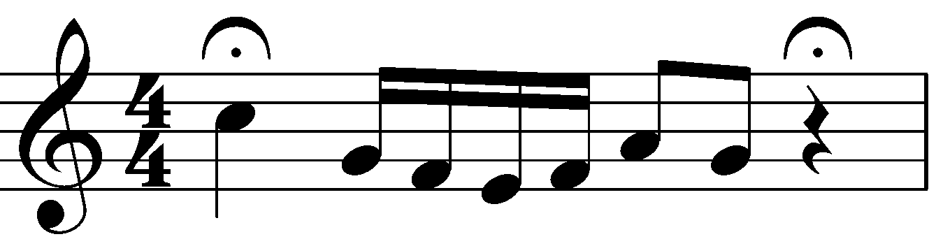 音符と休符に付いたフェルマータ