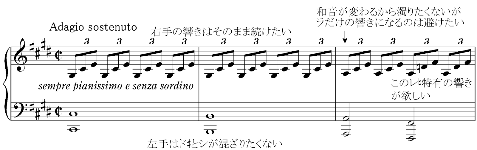 様式を外れた型破りのソナタ「月光」(ベートーヴェン)を解説!の画像